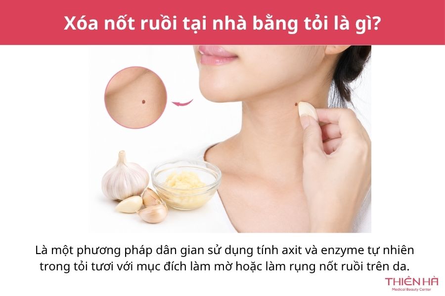 Cách xóa nốt ruồi tại nhà bằng tỏi: Hướng dẫn và lưu ý an toàn 1 Xóa nốt ruồi tại nhà bằng tỏi là gì?