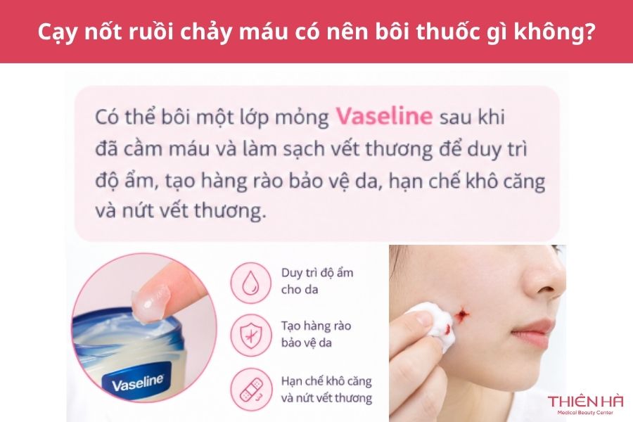 Cạy nốt ruồi chảy máu: Nguyên nhân, cách xử lý và khi nào khám 4 Cạy nốt ruồi chảy máu có nên bôi thuốc gì không?