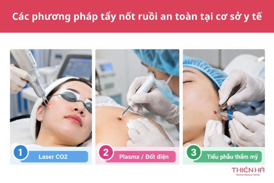 Tẩy nốt ruồi bằng phương pháp nào an toàn?