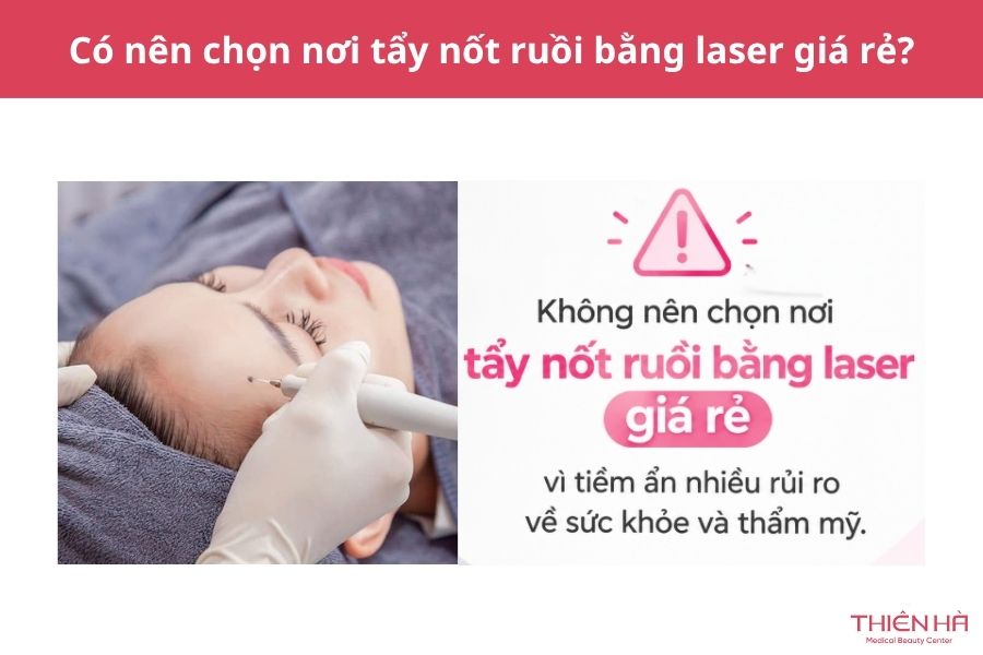 Có nên chọn nơi tẩy nốt ruồi bằng laser giá rẻ?