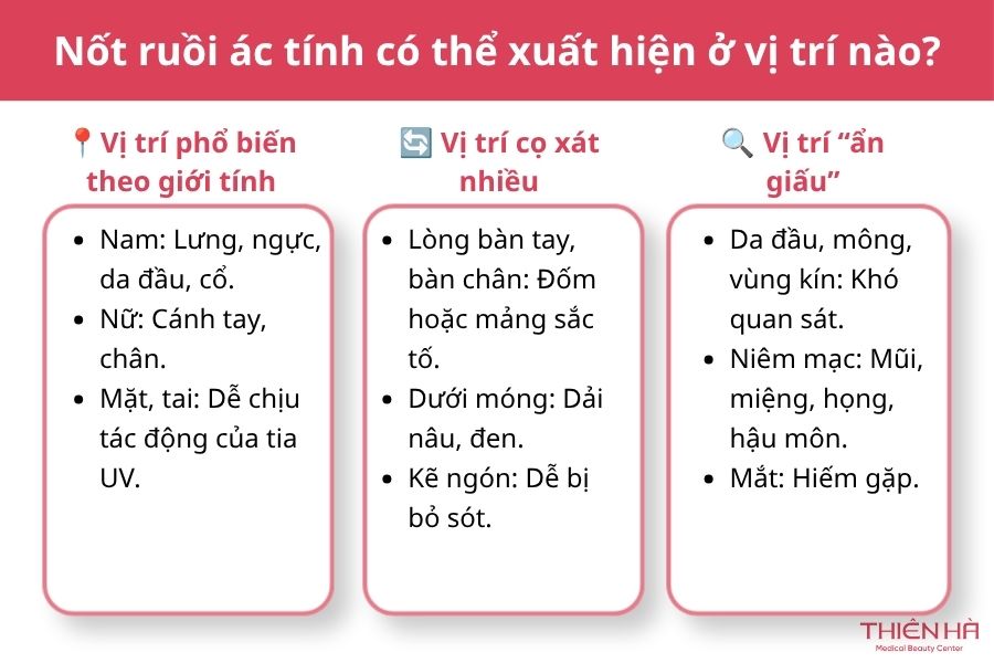 Nốt ruồi ác tính: Dấu hiệu nhận biết, nguy hiểm và cách xử lý 3 Nốt ruồi ác tính có thể xuất hiện ở vị trí nào?