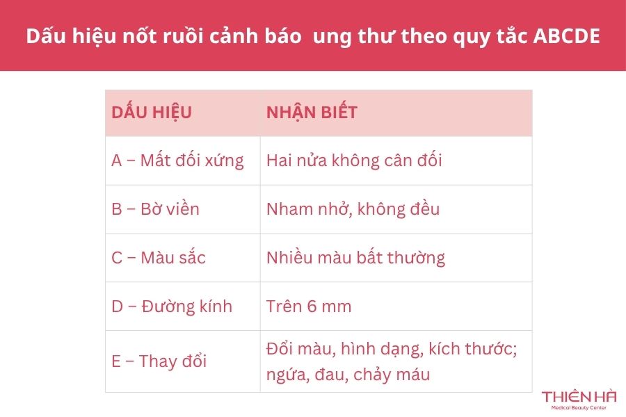 Nốt ruồi báo ung thư: Dấu hiệu nhận biết và khi nào cần khám 2 5 dấu hiệu nốt ruồi cảnh báo ung thư theo quy tắc ABCDE