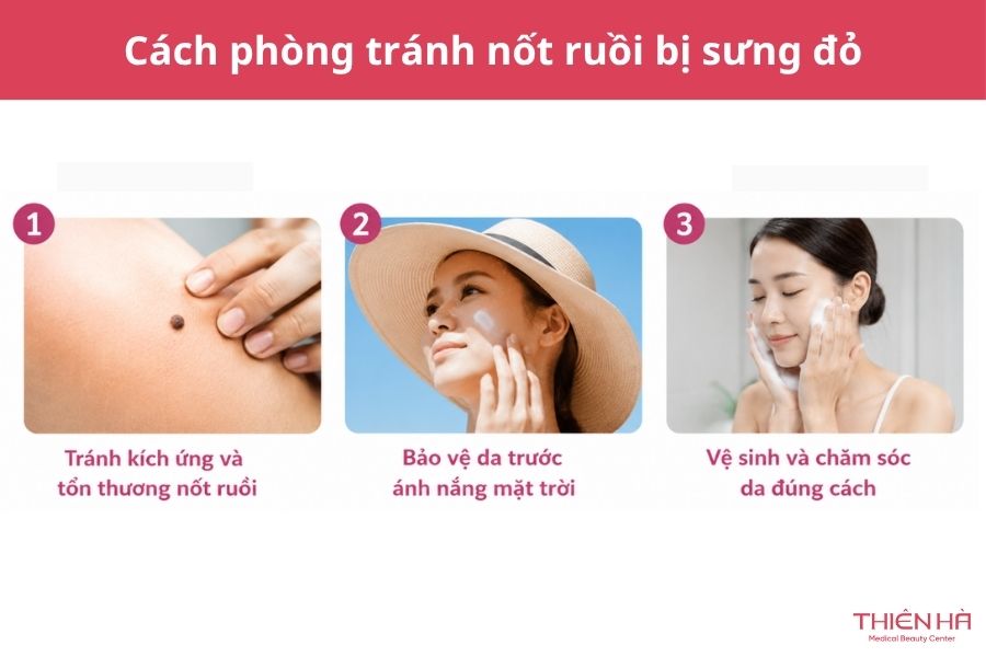 Nốt ruồi bị sưng đỏ: Vì sao xảy ra và khi nào cần đi khám? 6 Cách phòng tránh nốt ruồi bị sưng đỏ