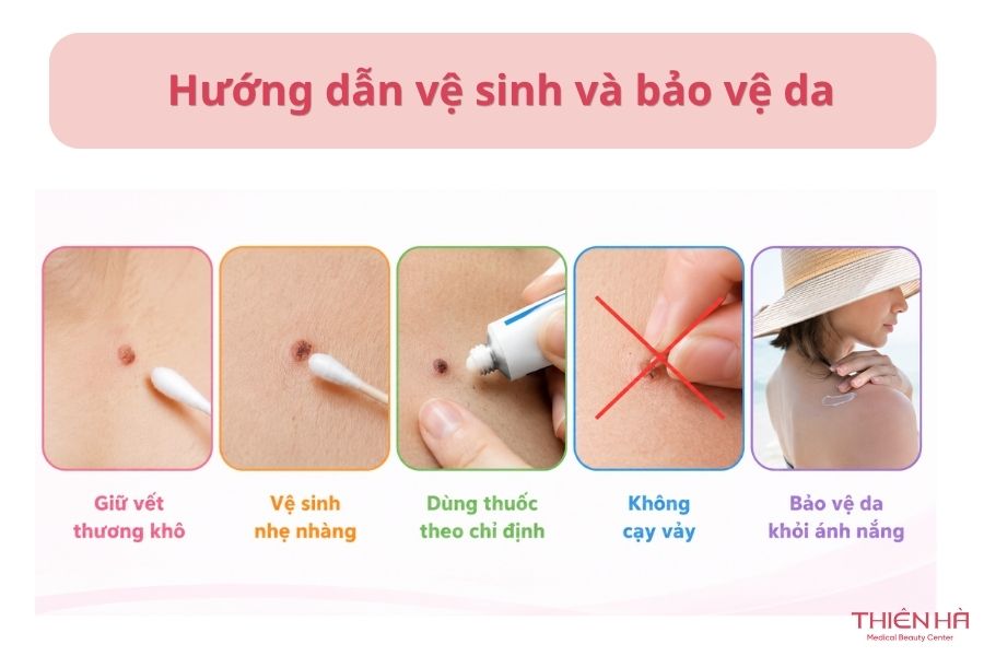 Nốt ruồi thịt là gì? Nguyên nhân, cách nhận biết và xử lý an toàn 8 Cách chăm sóc da sau khi xử lý nốt ruồi thịt