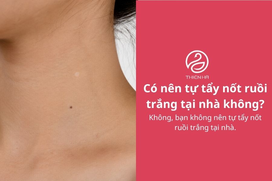 Nốt ruồi trắng: Nguyên nhân, mức độ nguy hiểm và cách xử lý 5 Có nên tự tẩy nốt ruồi trắng tại nhà không?