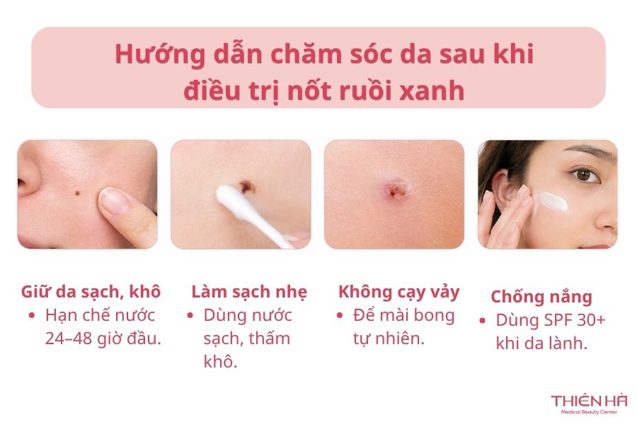 Nốt ruồi xanh có nguy hiểm không? Đặc điểm và cách xử lý phù hợp 8 Hướng dẫn chăm sóc da sau khi điều trị nốt ruồi xanh