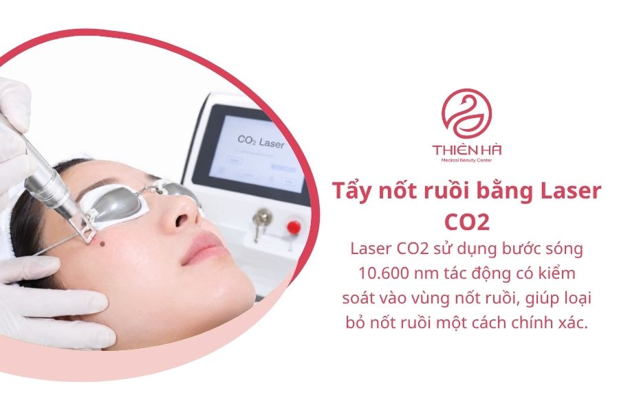 Tẩy nốt ruồi bằng Laser CO2