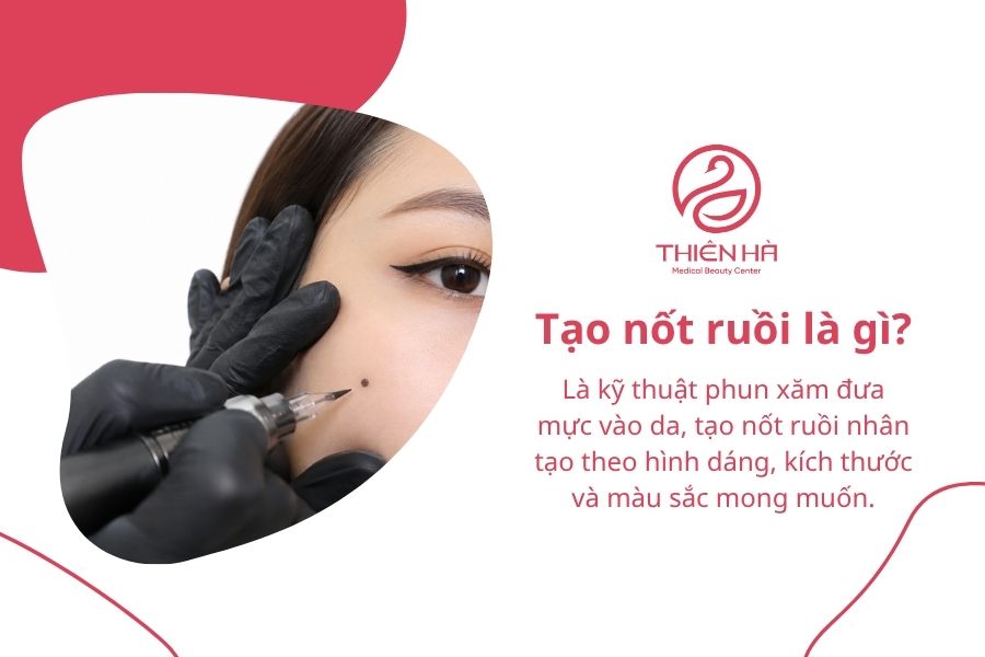 Tạo nốt ruồi đẹp tự nhiên: Phương pháp, độ bền và chi phí 1 Tạo nốt ruồi là gì?