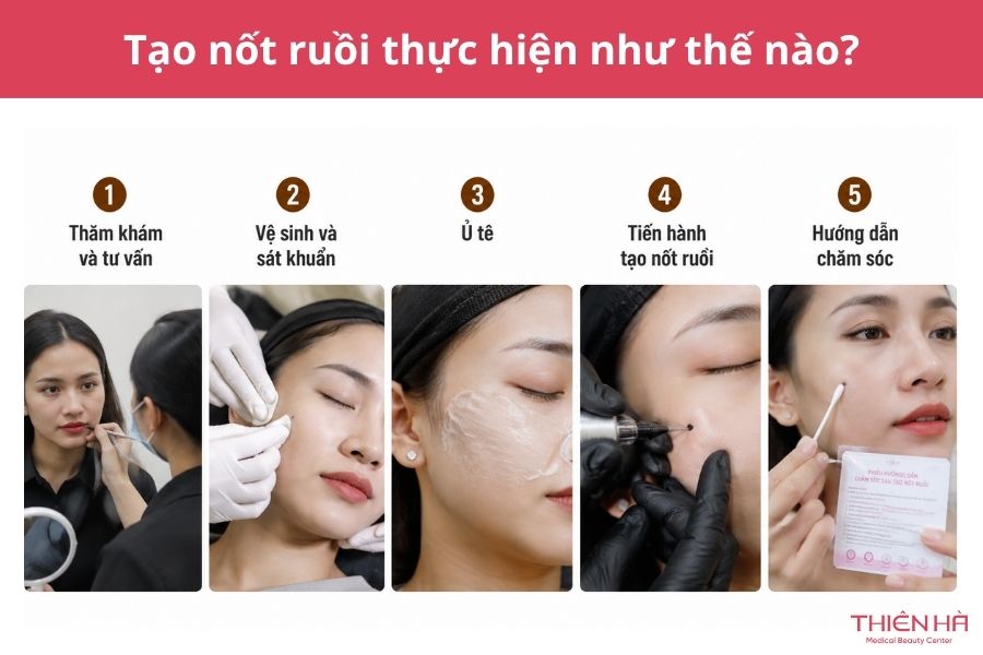 Tạo nốt ruồi đẹp tự nhiên: Phương pháp, độ bền và chi phí 4 Tạo nốt ruồi được thực hiện như thế nào?