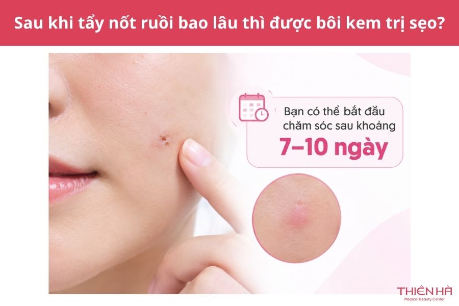 Sau khi tẩy nốt ruồi bao lâu thì được bôi kem trị sẹo?