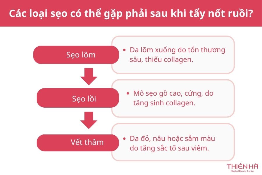 Các loại sẹo có thể gặp phải sau khi tẩy nốt ruồi