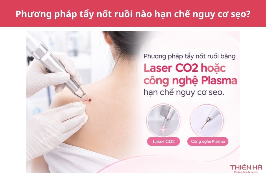 Tẩy nốt ruồi có để lại sẹo không? Nguyên nhân và cách hạn chế 5 Phương pháp tẩy nốt ruồi nào hạn chế nguy cơ sẹo?