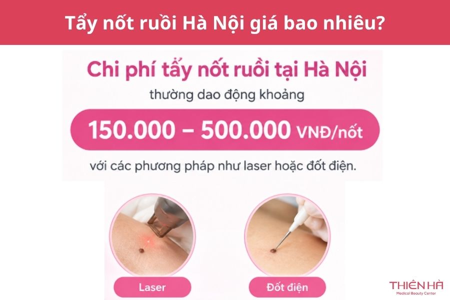 Tẩy nốt ruồi Hà Nội giá bao nhiêu?