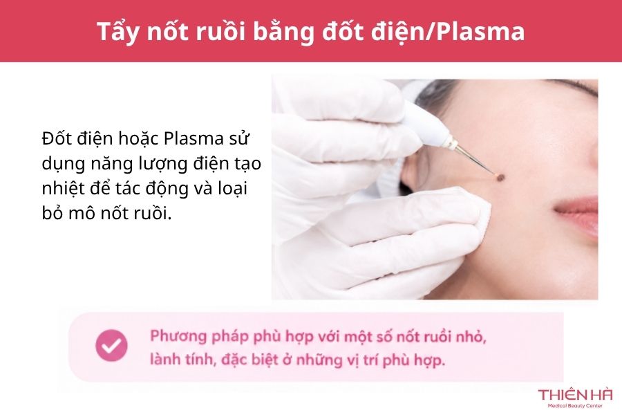 Thẩm mỹ tẩy nốt ruồi: Phương pháp, chi phí và lưu ý an toàn 3 Tẩy nốt ruồi bằng đốt điện/Plasma