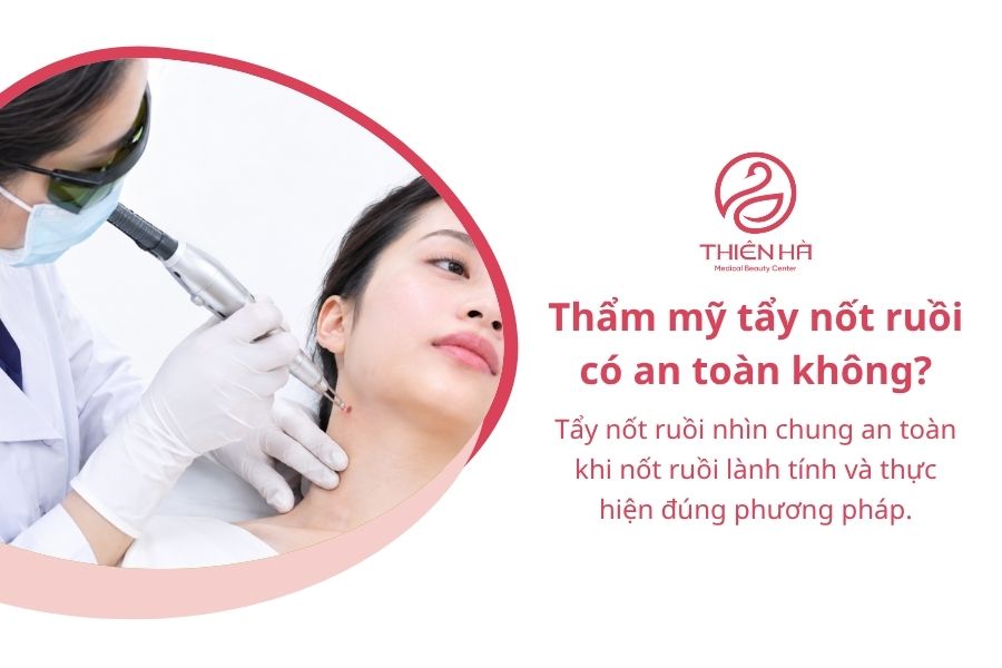 Thẩm mỹ tẩy nốt ruồi: Phương pháp, chi phí và lưu ý an toàn 4 Thẩm mỹ tẩy nốt ruồi có an toàn không?