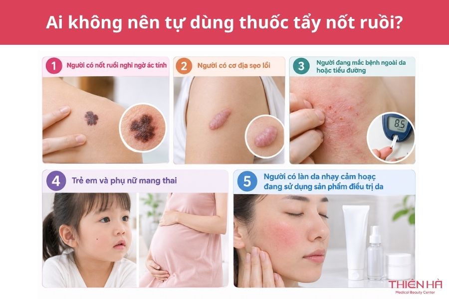Những ai không nên tự dùng thuốc tẩy nốt ruồi?