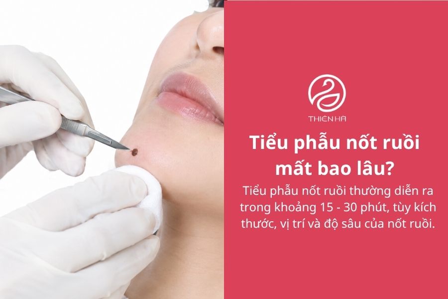 Tiểu phẫu nốt ruồi là gì? Quy trình, chi phí và cách chăm sóc 9 Câu hỏi thường gặp về tiểu phẫu nốt ruồi