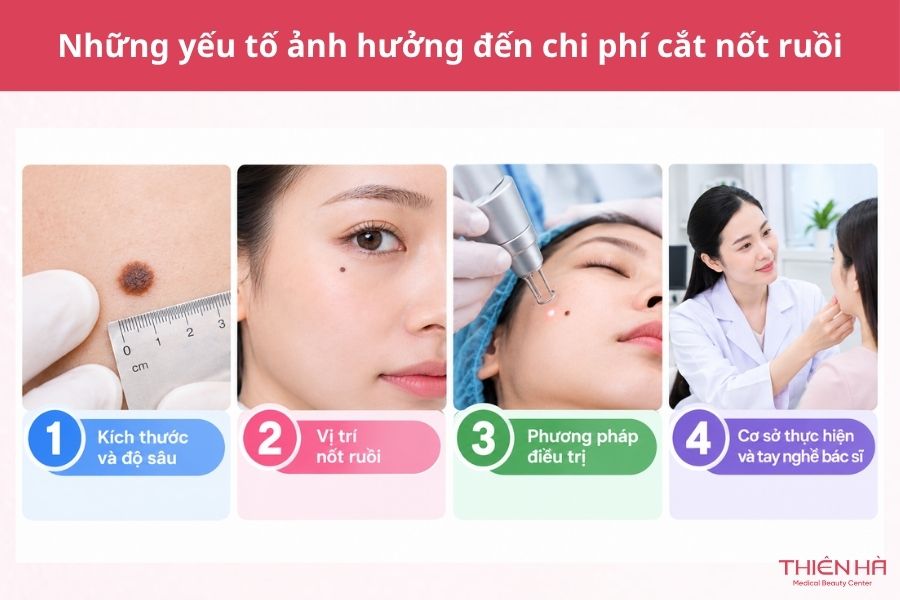 Tiểu phẫu nốt ruồi là gì? Quy trình, chi phí và cách chăm sóc 6 Những yếu tố ảnh hưởng đến chi phí cắt nốt ruồi