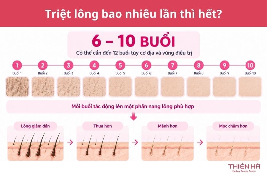 Triệt lông bao nhiêu lần thì hết? Giải đáp chi tiết 1 Triệt lông bao nhiêu lần thì hết? Câu trả lời từ chuyên gia