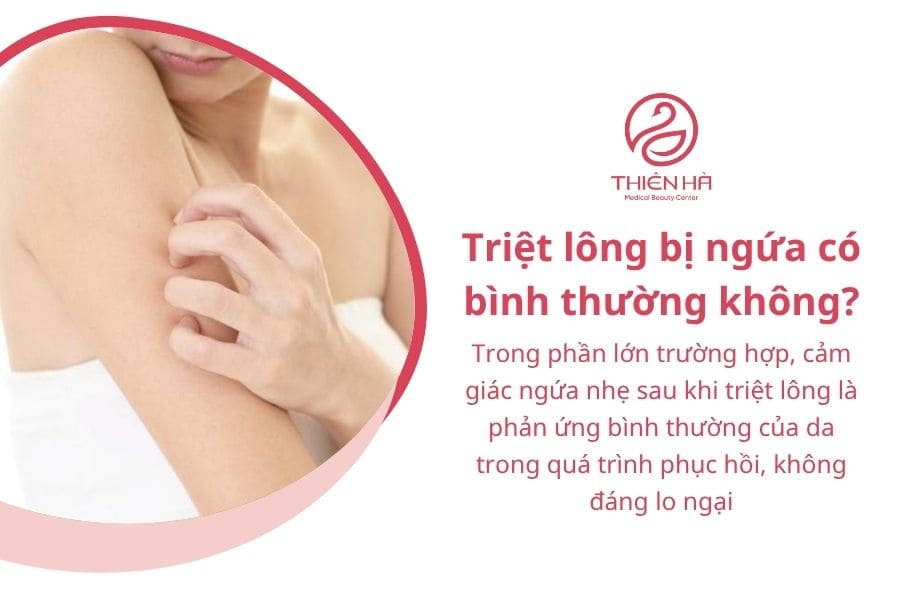 Triệt lông bị ngứa: Nguyên nhân và cách xử lý 1 Triệt lông bị ngứa có bình thường không?