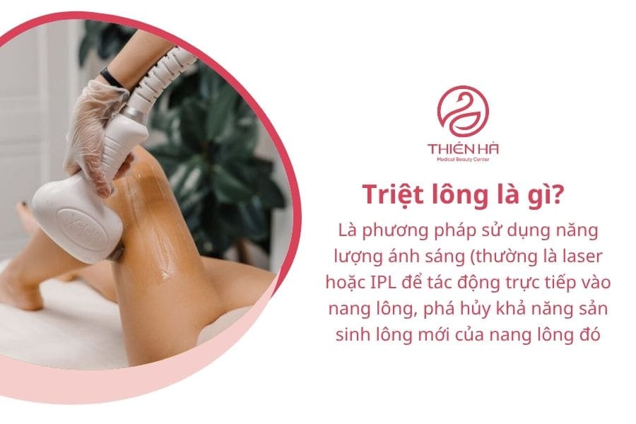 Triệt lông là gì?