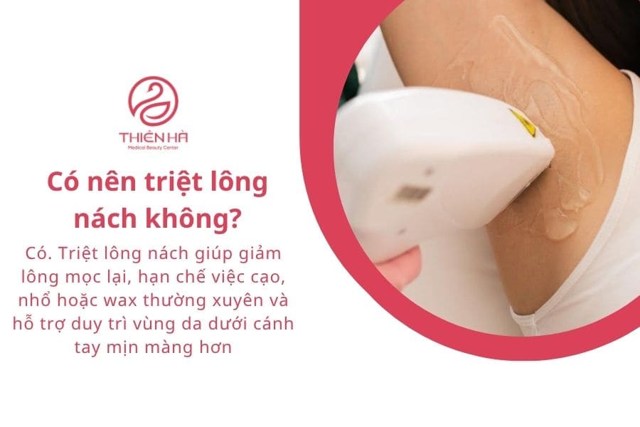 Có nên triệt lông nách không?