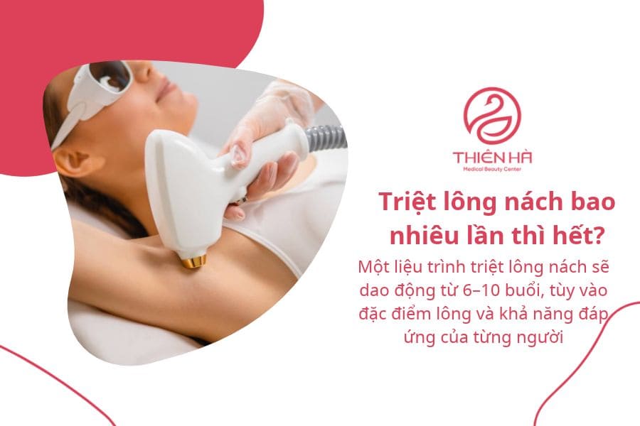 Triệt lông nách bao nhiêu lần thì hết? 1 Triệt lông nách bao nhiêu lần thì hết?
