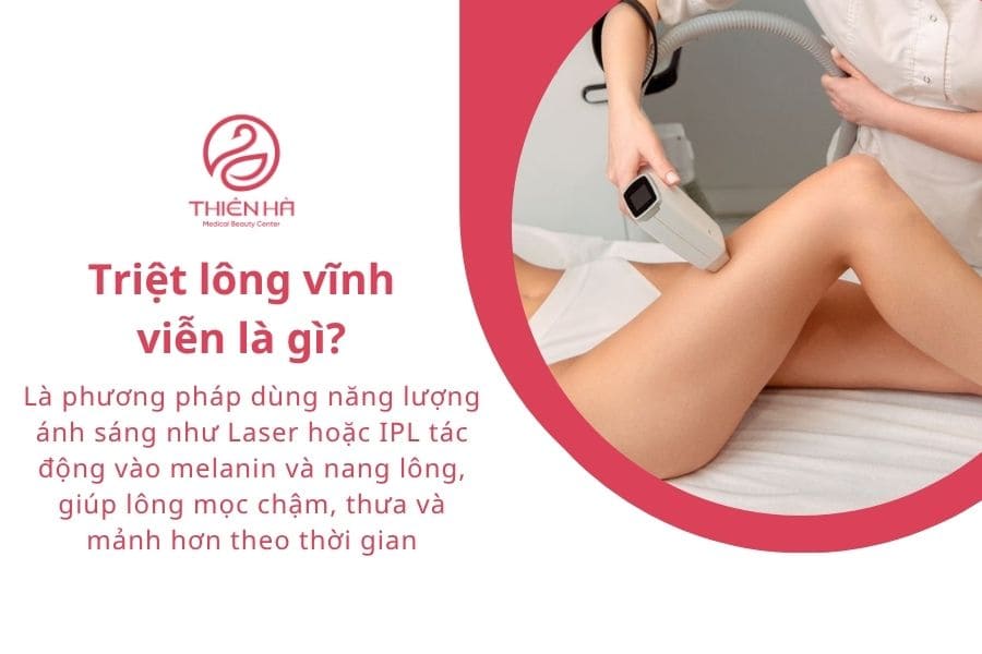Triệt lông vĩnh viễn là gì?