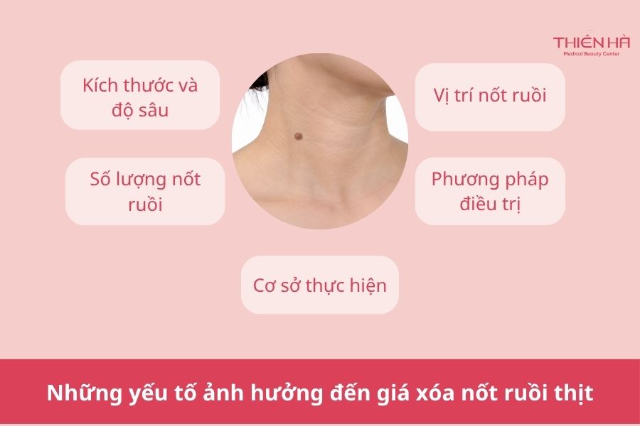 Xóa nốt ruồi thịt bằng cách nào? Phương pháp và chi phí thực hiện 5 Những yếu tố ảnh hưởng đến giá xóa nốt ruồi thịt