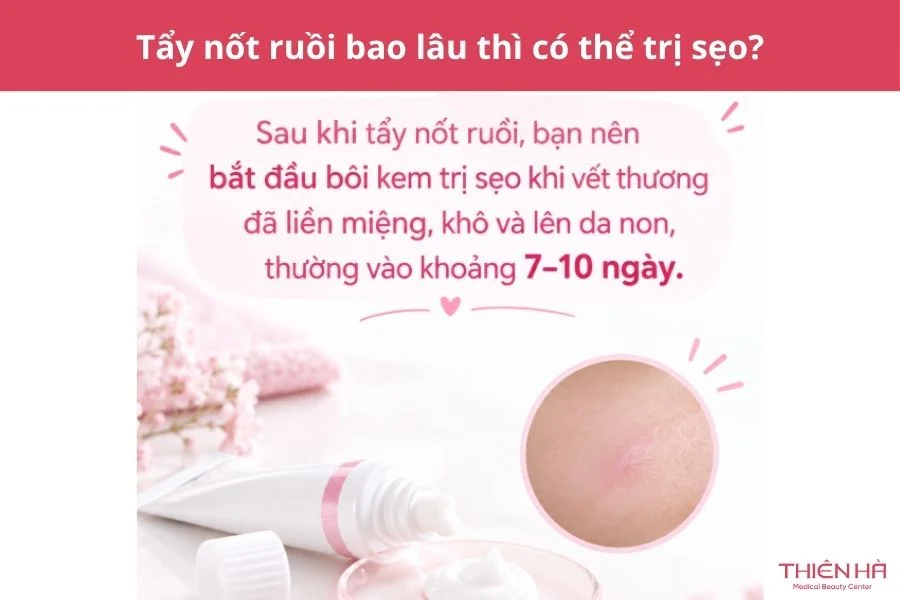 Tẩy nốt ruồi bao lâu thì có thể trị sẹo?