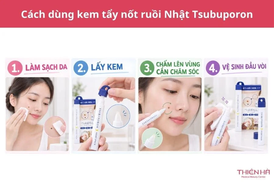Kem tẩy nốt ruồi của Nhật Tsubuporon: Giá, cách dùng, hiệu quả 3 Cách sử dụng sản phẩm kem tẩy nốt ruồi của Nhật Tsubuporon
