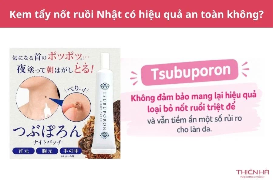 Kem tẩy nốt ruồi của Nhật Tsubuporon: Giá, cách dùng, hiệu quả 4 Kem tẩy nốt ruồi của Nhật có hiệu quả và an toàn không?