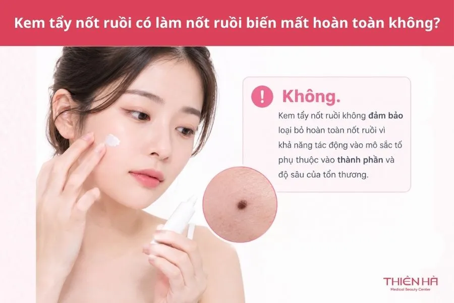 Kem tẩy nốt ruồi: Có an toàn không và nên tẩy bằng cách nào? 9 Câu hỏi thường gặp về kem tẩy nốt ruồi