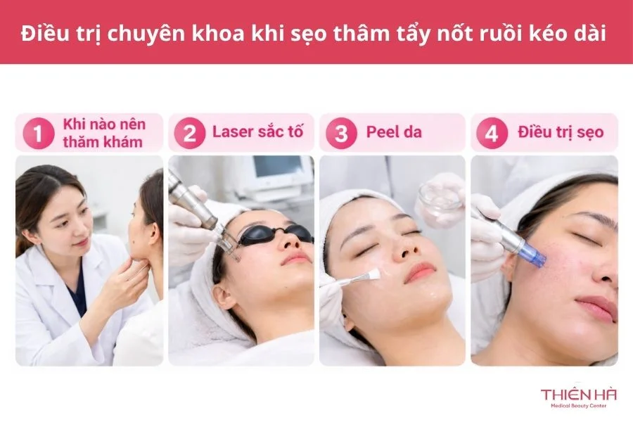 Điều trị chuyên khoa khi sẹo thâm tẩy nốt ruồi kéo dài 