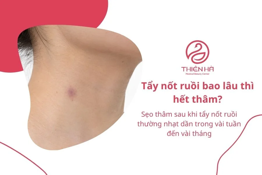 Câu hỏi thường gặp về sẹo thâm sau khi tẩy nốt ruồi