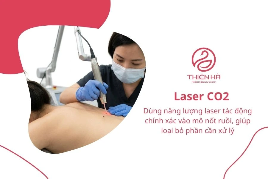 Tẩy nốt ruồi bằng chanh: 3 cách thực hiện và lưu ý an toàn 7 Laser CO2