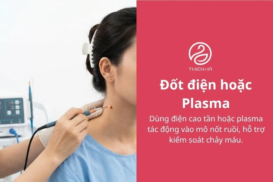 Tẩy nốt ruồi bằng chanh: 3 cách thực hiện và lưu ý an toàn 8 Đốt điện hoặc Plasma