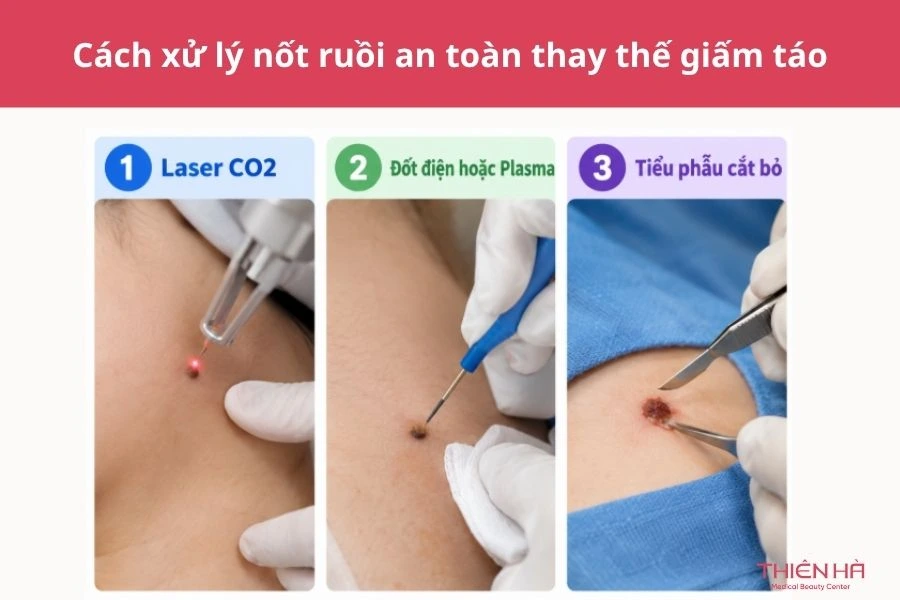 Cách xử lý nốt ruồi an toàn thay thế giấm táo