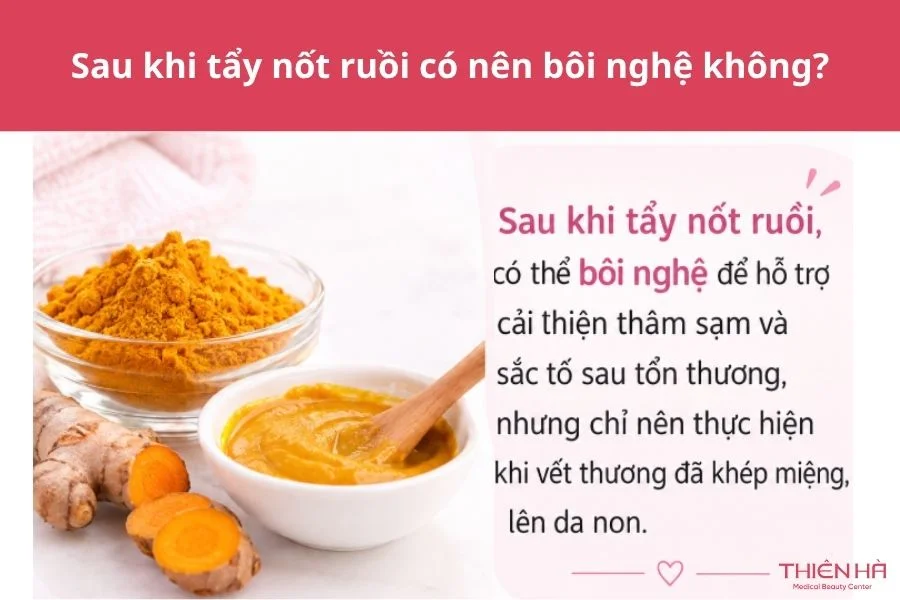 Sau khi tẩy nốt ruồi có nên bôi nghệ không?