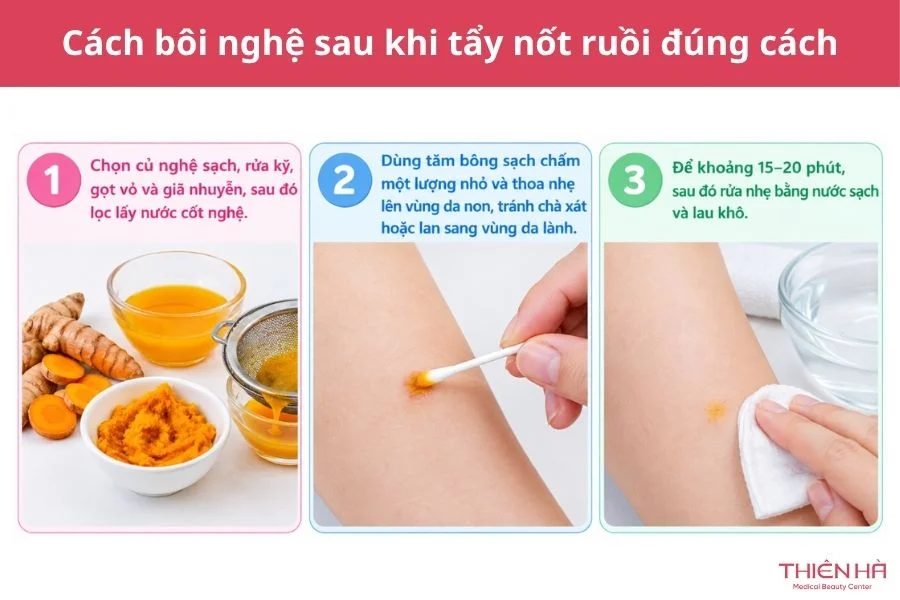 Cách bôi nghệ sau khi tẩy nốt ruồi đúng cách