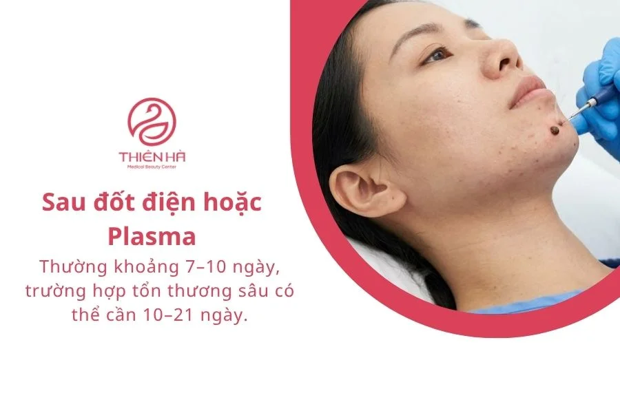 Sau đốt điện hoặc Plasma