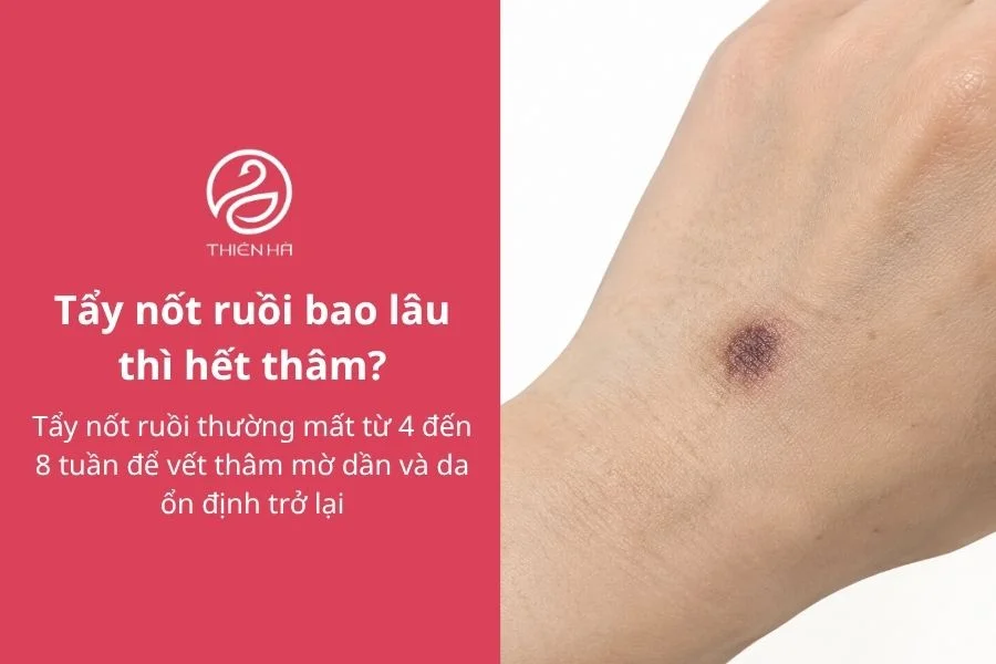 Tẩy nốt ruồi bao lâu thì hết thâm? Bí quyết giúp da đều màu hơn 2 Tẩy nốt ruồi bao lâu thì hết thâm?