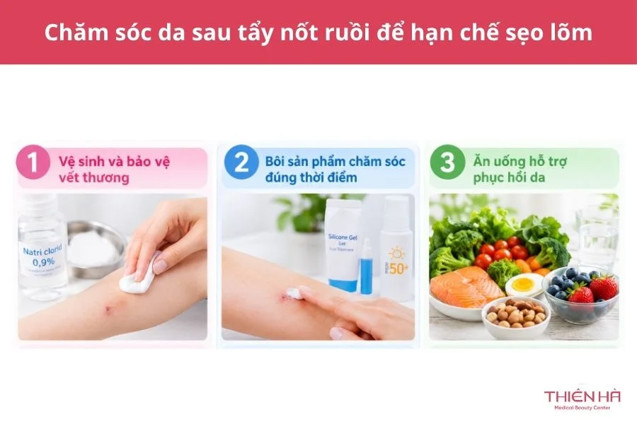 Chăm sóc da sau tẩy nốt ruồi để hạn chế sẹo lõm