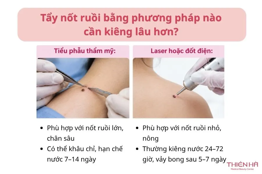 Tẩy nốt ruồi bằng phương pháp nào cần kiêng lâu hơn?