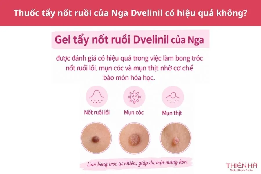 Thuốc tẩy nốt ruồi của Nga Dvelinil có hiệu quả không?
