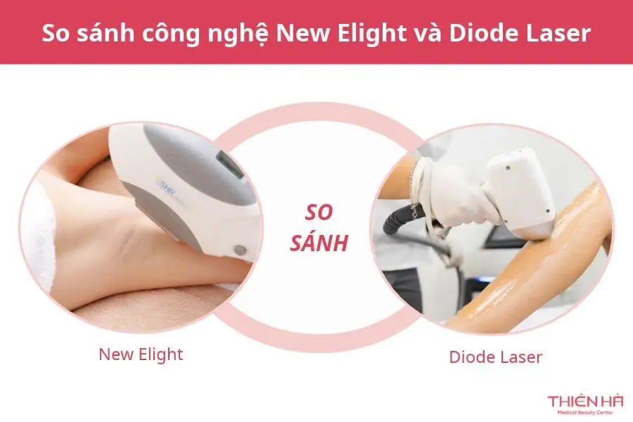 So sánh công nghệ New Elight và Diode Laser