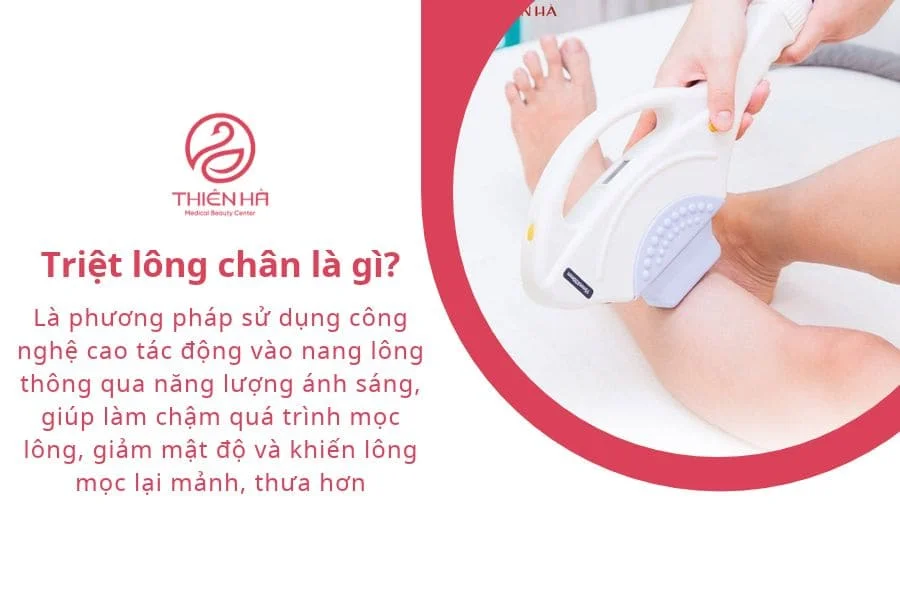 Có nên triệt lông chân không? Những điều cần biết 1 Triệt lông chân là gì?