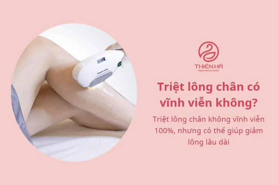 Có nên triệt lông chân không? Những điều cần biết 5 Triệt lông chân có vĩnh viễn không?