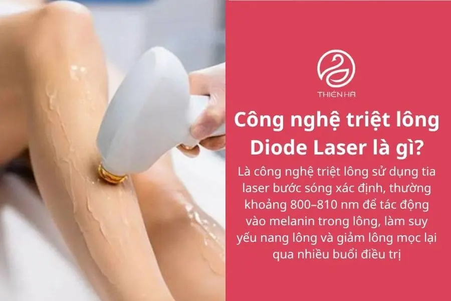 Công nghệ triệt lông Diode Laser là gì?