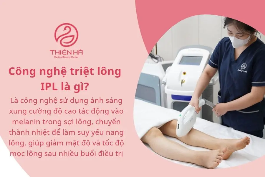 Triệt lông IPL: Ưu nhược điểm, chi phí và lưu ý 1 Công nghệ triệt lông IPL là gì?